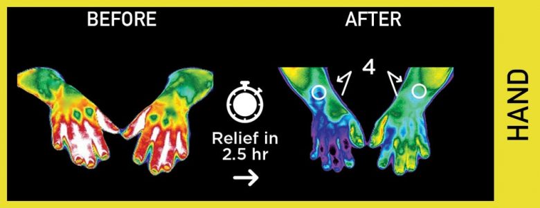 pain relief disc for hands