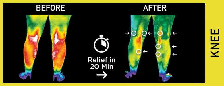 pain relief disc for knees